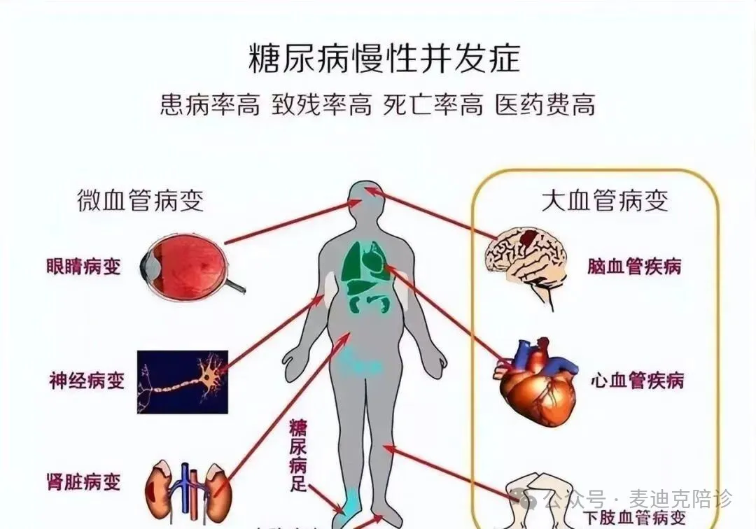 糖尿病饮食管理需科学控糖,吃出健康与甜蜜