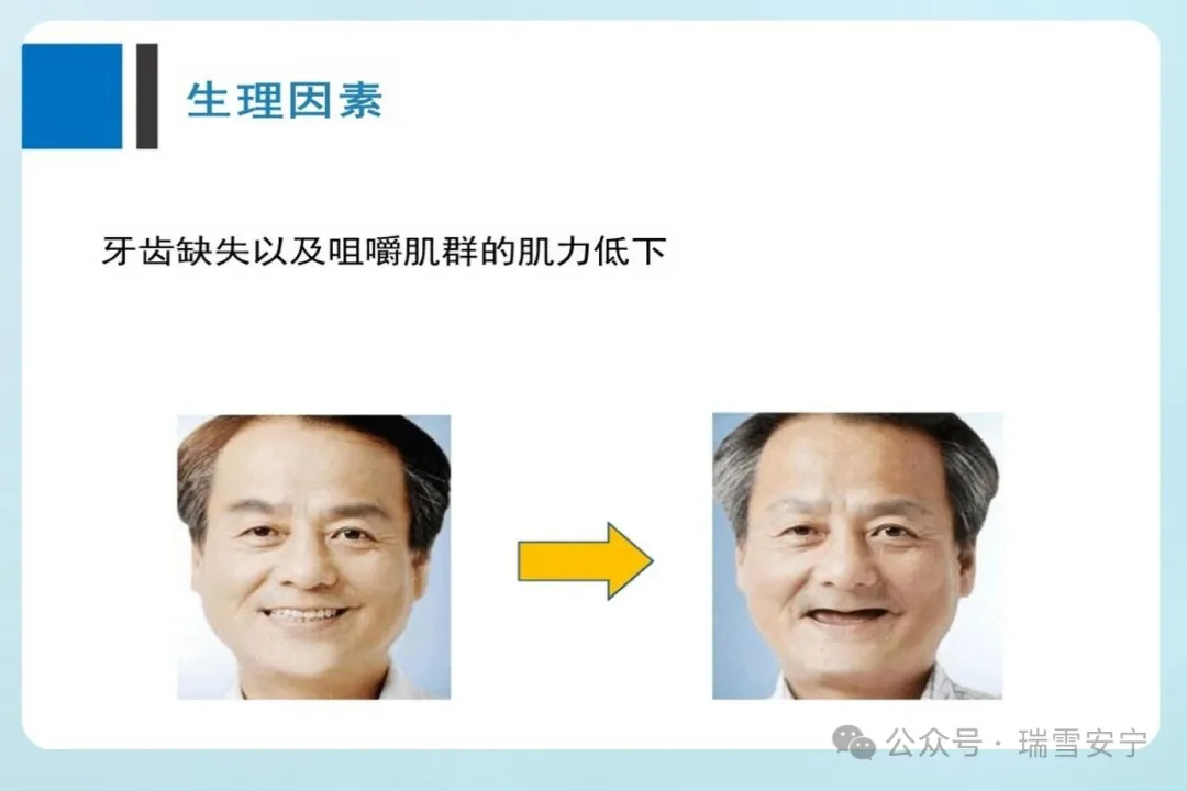 老年人饮食与排泄照护小常识